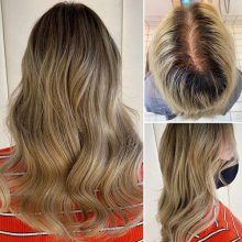 Before and after by Leyla at the klinik salon London 